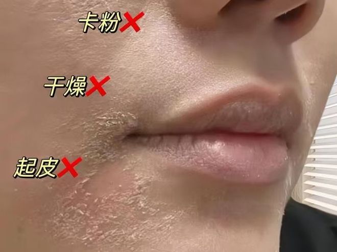 2025男士补水保湿水乳实测！混油皮亲测锁水懒人福音！